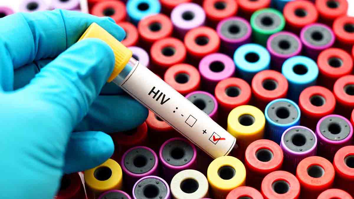 ۲۳ هزار مبتلای رسمی به ایدز در کشور/ ۷ درصد از مبتلایان خدمات درمانی می‌گیرند