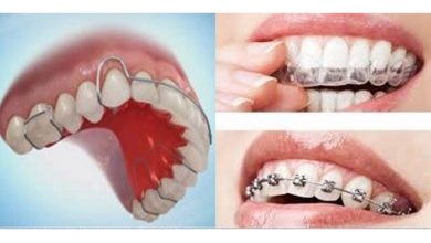 ارتودنسی دندان چگونه است؟