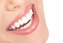 ایمپلنت دندان اروپایی با برند با کیفیت و گارانتی