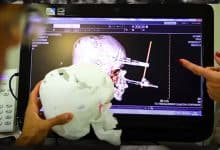 چرا بیمارستان ها به چاپگرهای سه بعدی احتیاج دارند؟
